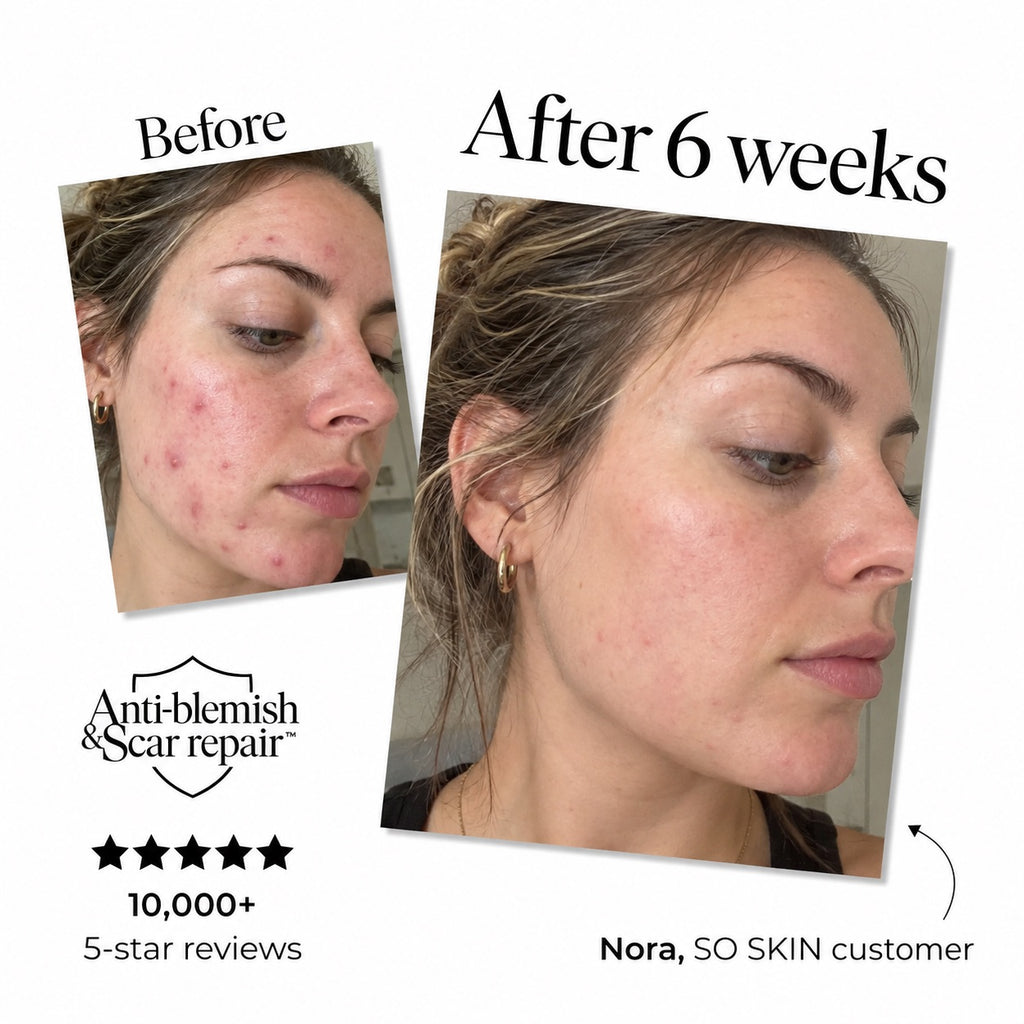 SO Skin Everyday Cleanser — gallery 2