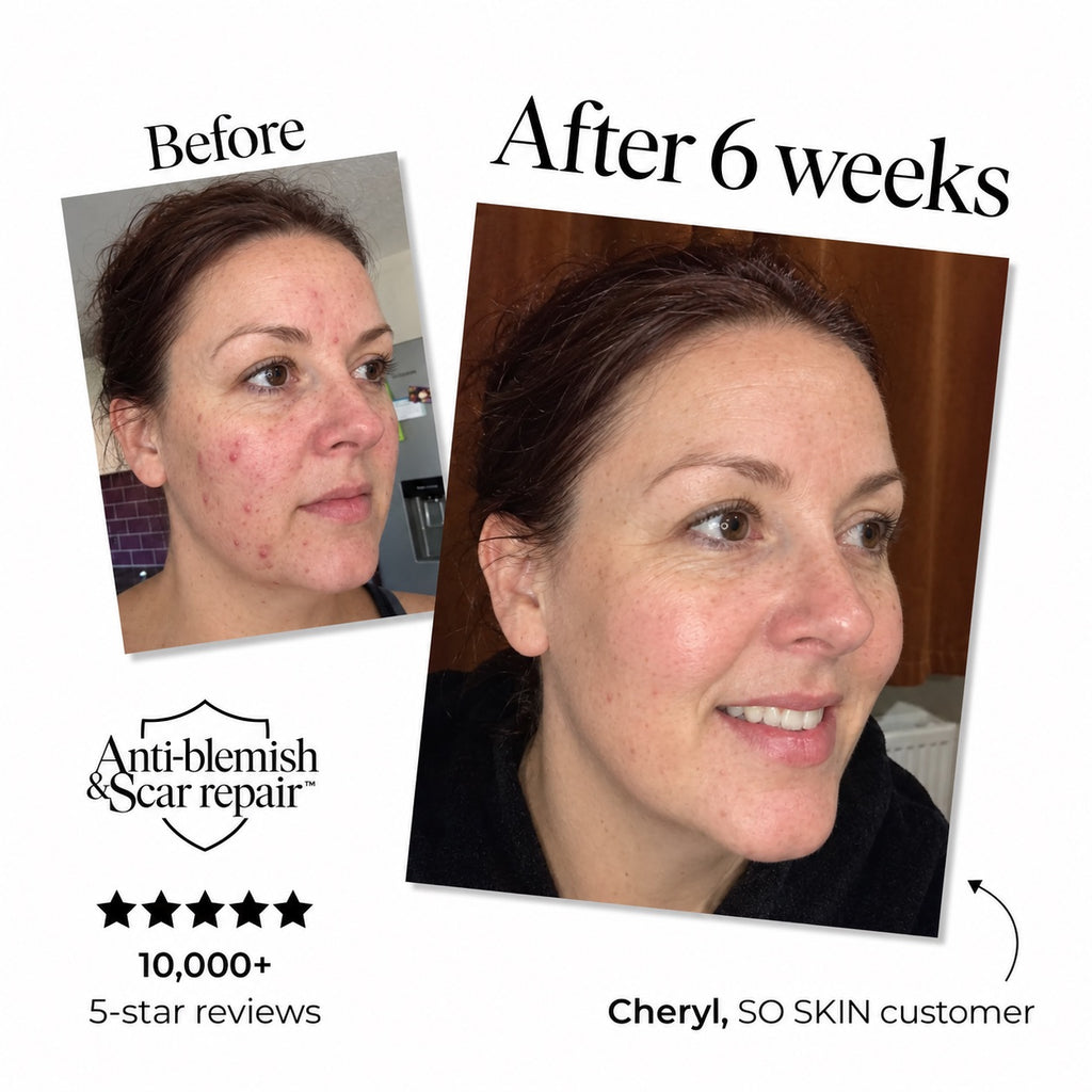 SO Skin Silver Mask — gallery 2