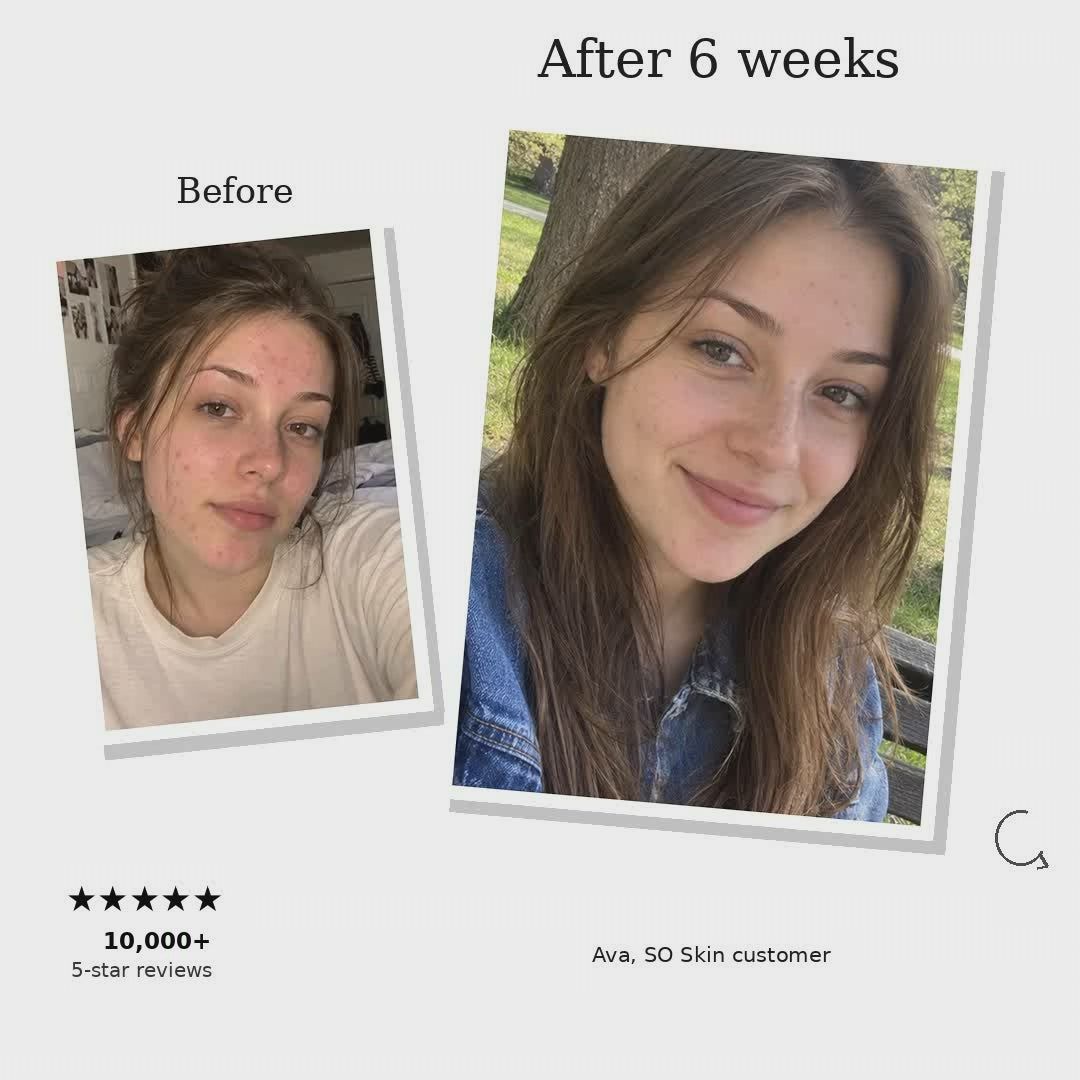 SO Skin Serum — gallery video 4