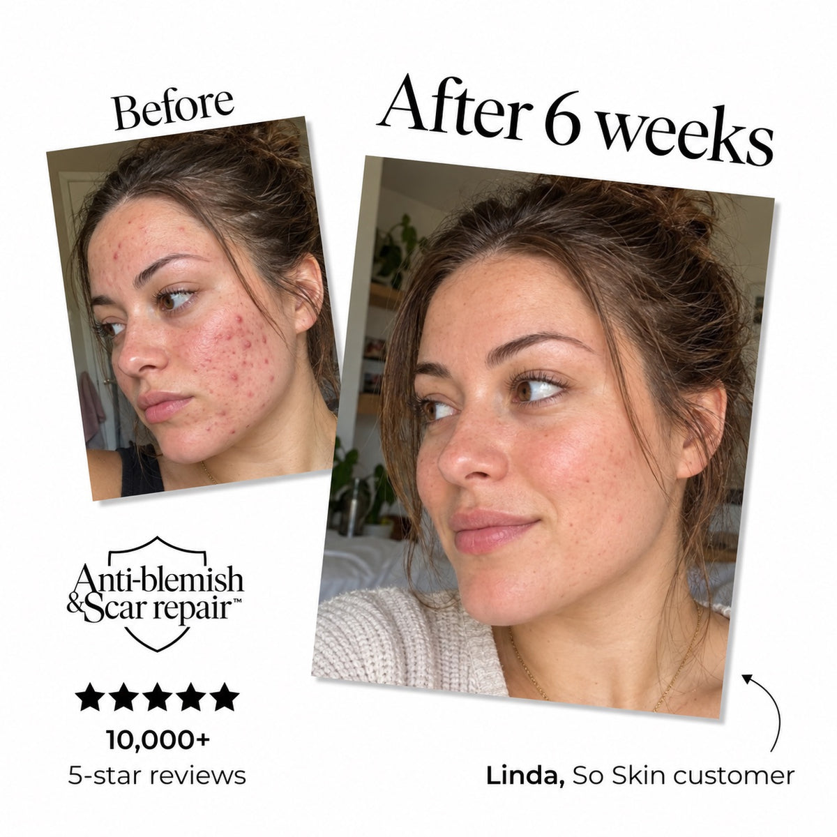 SO Skin Serum — gallery 2